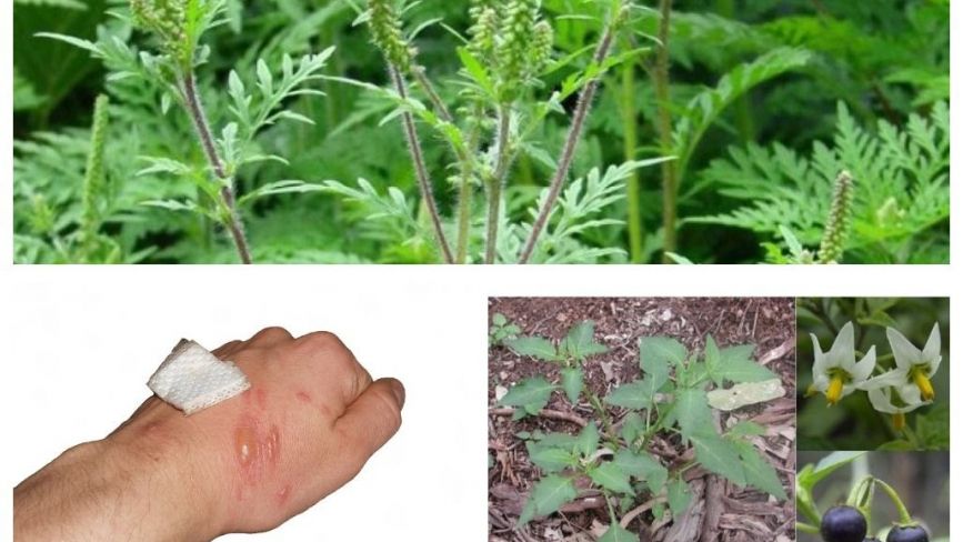 «Руки ніби обпечені, може бути і гірше»: які отруйні та небезпечні рослини є на Тернопільщині