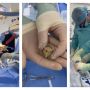 У Тернополі вперше в області замінили серцевий клапан без відкритої операції
