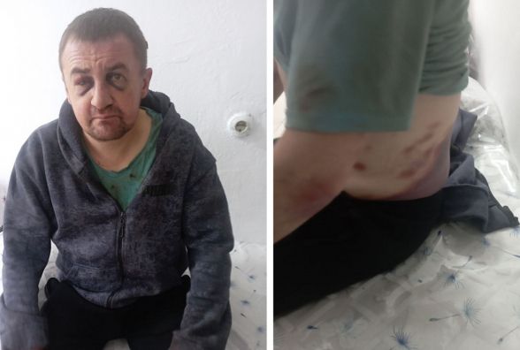 Чоловіка забрали в ТЦК, а через три дні дружина знайшла його побитим біля Почаївської лаври
