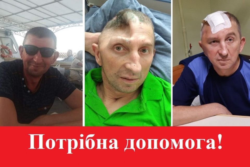 Отримав тяжке поранення під Бахмутом: тепер воїну з Тернопільщини потрібна наша допомога
