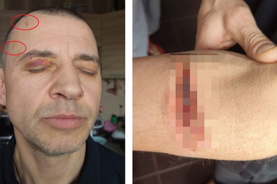 Заявляє, що його катували у ТЦК і незаконно мобілізували. А на паперах: він перебуває в СЗЧ