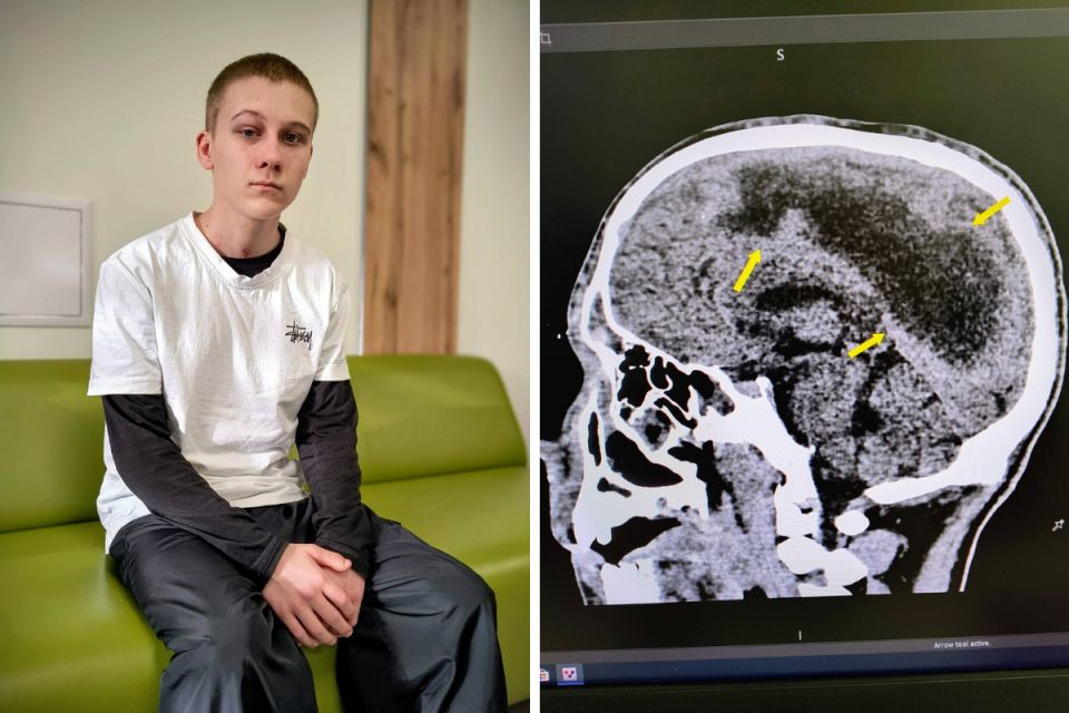 Впав у кому після застуди: у Львові лікарі врятували 16-річного хлопця