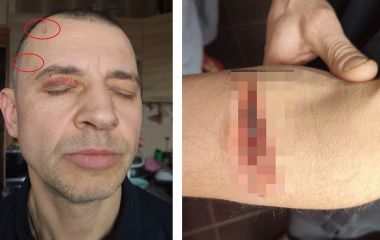 «Видавлювали очі, душили, нещадно катували в ТЦК». Тернополянин просить розголосу