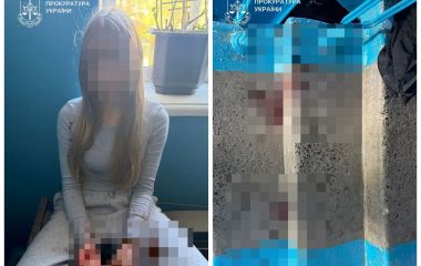 Бійка між однокласницями у Тернополі завершилася ножовим пораненням