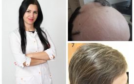 Унікальний випадок: жителька Тернопільщини 25 років ходила в перуці. Тепер розчісує своє волосся