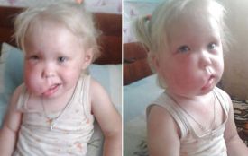 Порятунок дворічної Надійки Славко під загрозою зриву: операцію відмінили