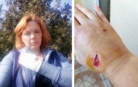 У Тернополі пес накинувся на заслужену артистку Оксану Малінович. Тепер її чекають лікарня і уколи