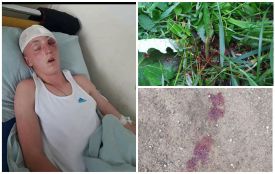 "Побили і залишили помирати на дорозі": хлопцям з Підгаєччини потрібна допомога. Стан важкий (18+)