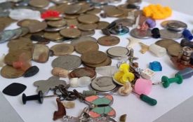 Батарейки, молочні зуби та лампочки: лікарі розповіли що найчастіше ковтають діти