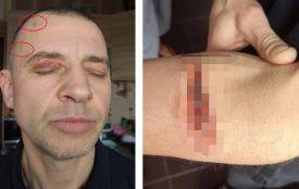 «Видавлювали очі, душили, нещадно катували в ТЦК». Тернополянин просить розголосу