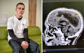 Впав у кому після застуди: у Львові лікарі врятували 16-річного хлопця