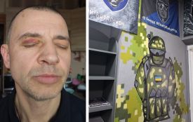 Розбіжності в документах та СЗЧ: позиція бригади й ТЦК щодо тернополянина, який заявив про катування