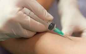 Замість проби Манту: з квітня Україна переходить на нові методи виявлення туберкульозу