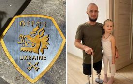 Пережив понад 100 операцій і створює авторські вироби з металу: історія захисника Олександра Безверхнього