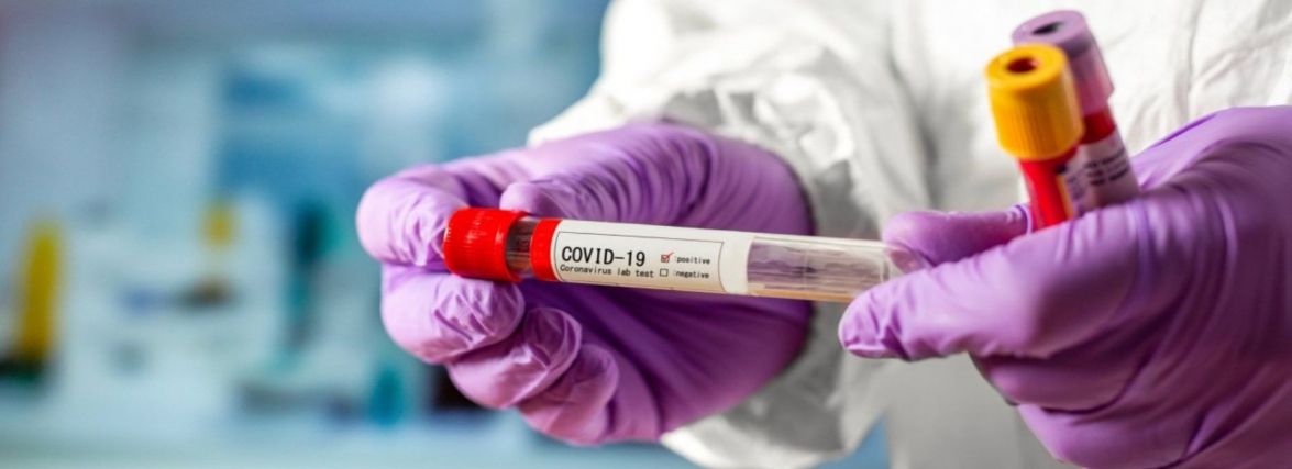 Covid-19 забрав життя 21 жителя Тернопільщини за останню добу, серед них 36-річна жінка