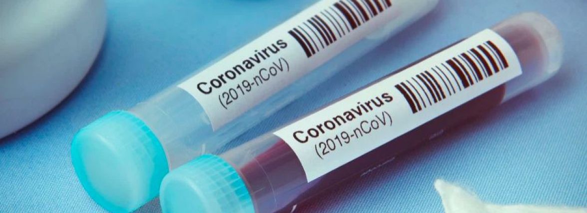На Тернопільщині 86 випадків Covid-19 за добу, 2 людини померли. Дані по Україні