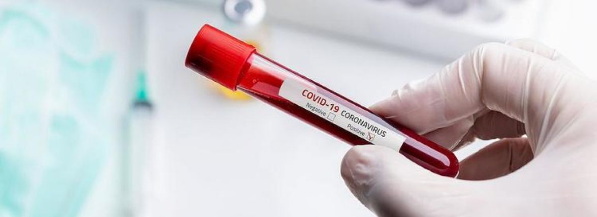 Covid-19 на Тернопільщині: за добу 3 людей померли, 179 захворіли. Ситуація в Україні
