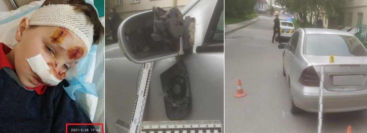 Хто «зливає» справу? Чому 7-річного Давидка, якого збив Mercedes у дворі, навіть не визнали потерпілим