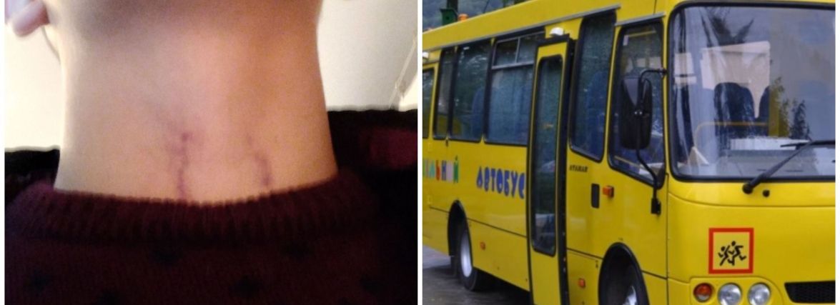 Схопив за сорочку, а на шиї садна: батько каже, що водій шкільного автобуса побив його сина. Як усе було?