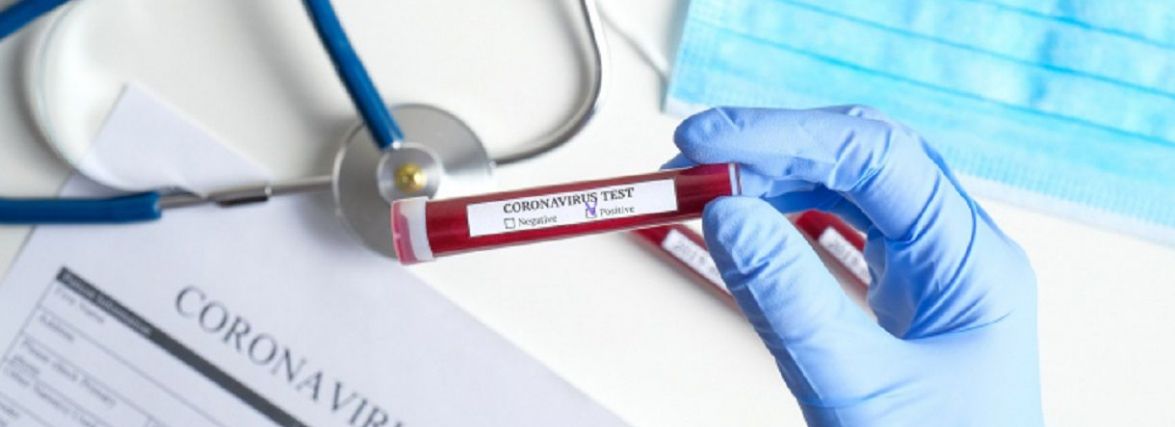 За добу Covid-19 забрав життя 13 жителів краю. Скільки нових хворих в області