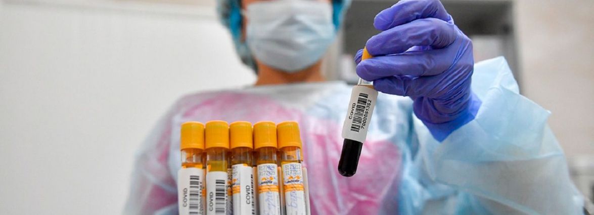 Covid-19 на Тернопільщині: за добу жодного летального випадку, майже 400 нових хворих