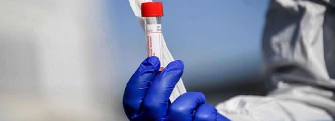 Covid-19 забрав життя 9 жителів області. Скільки нових хворих виявили за добу