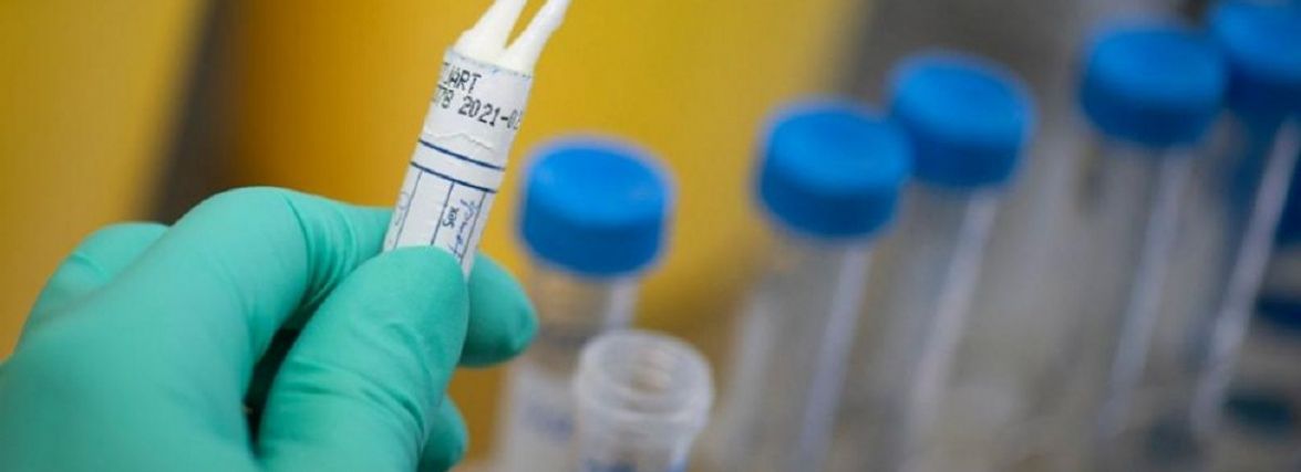 Коронавірус за добу забрав життя 7 жителів краю, ще понад 900 захворіли. Дані по районах